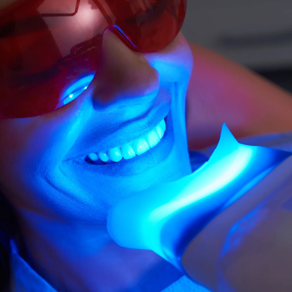 Blanqueamiento dental en Algeciras