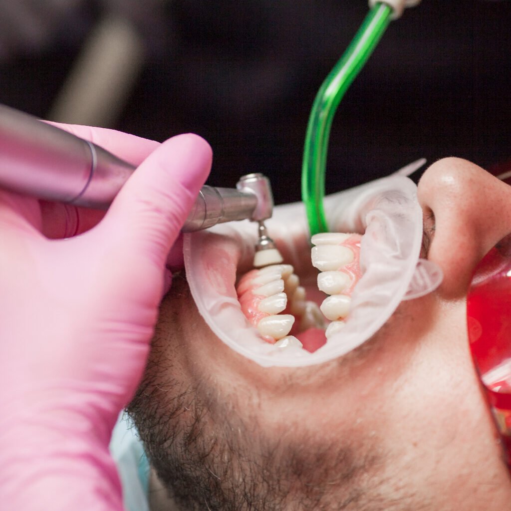 Periodoncia en Algeciras