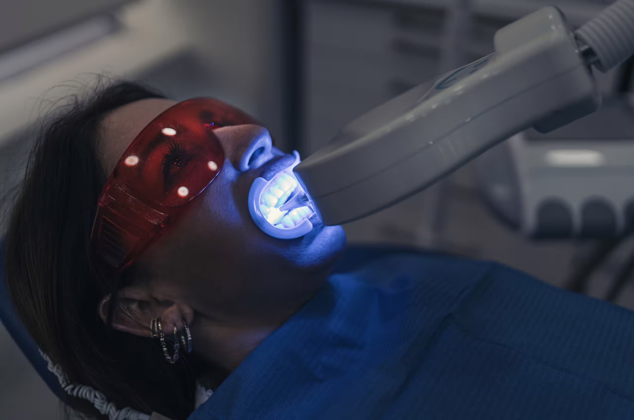 Tipos de blanqueamiento dental