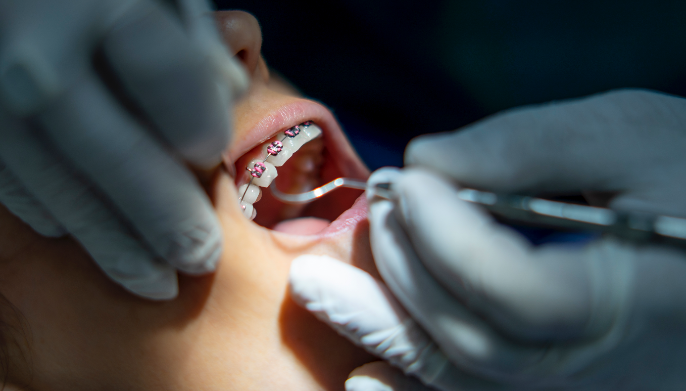 Ortodoncia en Algeciras