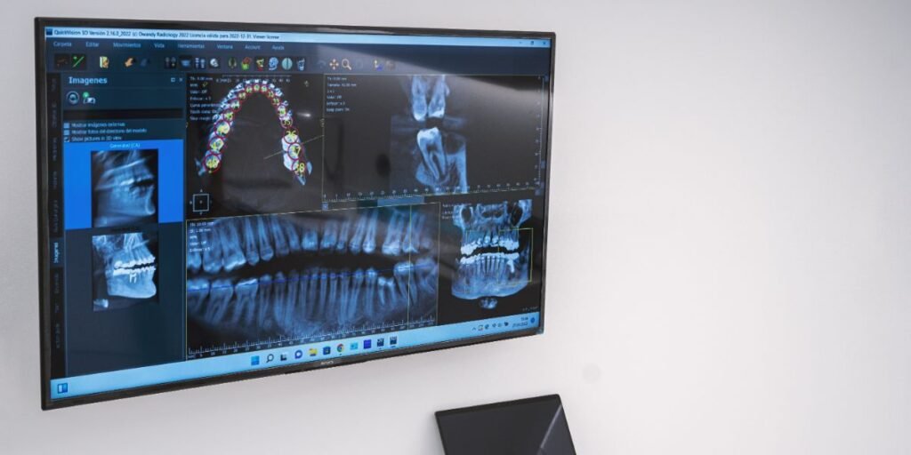 Implantes dentales en Algeciras