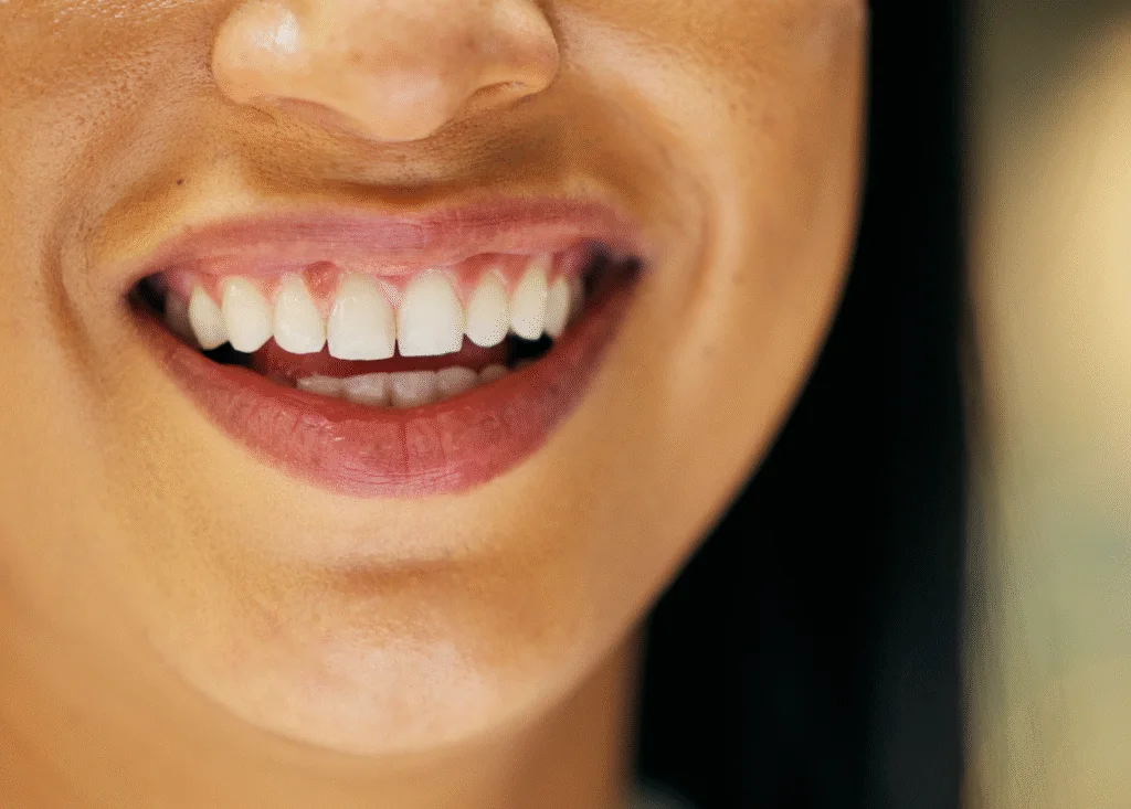Beneficios clave de los implantes dentales Beneficios clave de los implantes dentales