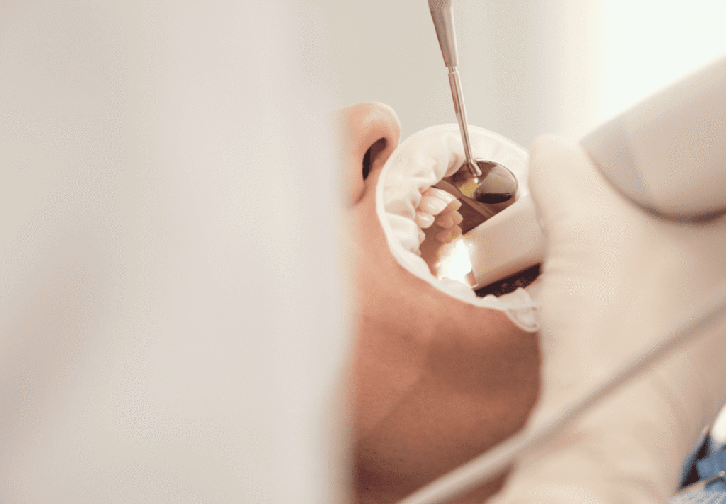 Endodoncia en Algeciras